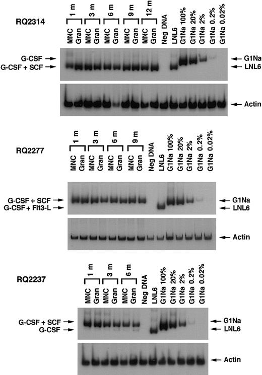 Fig. 2. PCR analysis of in vivo marking. / Representative PCR of neo and β-actin sequences in PB mononuclear cells (MNCs) and granulocytes (Gran) at different time points after engraftment in 3 animals. Concurrentβ-actin PCR was performed for each sample to quantitate the amount of amplifiable template DNA. Serial dilutions of G1Na DNA (2 copies of integrated vector per cell) into normal rhesus PB DNA were used as positive controls. In animals RQ2314 and RQ2277 the only amplified band corresponds to the vector that was used to transduce G-CSF+SCF–mobilized cells. In animal RQ2237 in addition to the band corresponding to G-CSF+SCF aliquot, a very faint band can be seen that corresponds to transduced G-CSF–mobilized cells.
