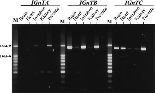 Fig. 3. Expression profiles for the. / IGnT gene from various human tissues. Poly A+ RNA samples from the human brain (cerebellum), heart, small intestine, kidney, and prostate were primed using oligo-dT primer to synthesize the first-strand cDNA. Then, PCR using gene-specific forward primer and common reverse primer was performed, as described in “Patients, materials, and methods.” The RT-PCR products were analyzed using 1.5% agarose gel electrophoresis. The expected sizes of the products from the IGnTA, IGnTB, andIGnTC transcripts were 1486, 1391, and 1326 bp, respectively. From RT-PCR for the IGnTA, an additional product approximately 500 bp in size, consisting of a shorter exon 1A region conjoining with exon 2-3 regions, was observed. This smaller product is believed to result from alternative splicing and does not have a correct reading frame relative to the exon 2-3 coding sequence. The faint bands (indicated by an asterisk) below those of theIGnTA 1486-bp fragment were the hybrid complex of theIGnTA 1486-bp and the alternatively spliced 500-bp products.