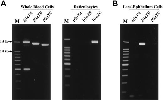 Fig. 6. RT-PCR analyses of. / IGnT gene expression in the RNA samples purified from whole blood cells and reticulocytes and from lens-epithelium cells. Pure reticulocytes were isolated from whole blood through positive isolation of cells expressing the transferrin receptor (CD71) by immunomagnetic separation, as described in “Patients, materials, and methods.” Total RNA from whole blood cells (the buffy coat layer) and reticulocytes (A) and lens-epithelium cells (B) was prepared, and RT-PCR analysis for the IGnTA, IGnTB, andIGnTC transcripts was conducted as described in “Patients, materials, and methods” and the legend of Figure 3.