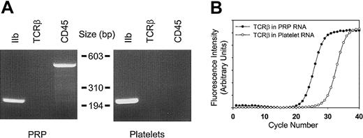Fig. 2. Determination of platelet purity. / (A) Total cellular RNA (1.8 μg) from platelet-rich plasma (PRP) or purified platelets from a single apheresis donor were analyzed by RT-PCR (35 cycles) using oligonucleotide primers specific for glycoprotein IIb (GPIIb), T-cell receptor β-chain (TCRβ), or CD45; 10 μL of the 50 μL reactions were analyzed by ethidium-stained agarose gel electrophoresis. Minimal to no TCRβ gene product was visually evident only in PRP. Size markers corresponding toHaeIII-restricted φX174 DNA are shown. (B) Real-time RT-PCR was completed by using 1.8 μg total RNA and TCRβ-specific oligonucleotide primers optimized for quantitative analysis by real-time PCR.18 On the basis of parallel determinations using RNA isolated from known amounts of purified leukocyte standards, the leukocyte-depletion protocol represents an approximate 2.5-log purification from the starting PRP. Results are representative of one complete set of experiments repeated on 2 separate occasions, and data points represent the mean from triplicate wells, with standard errors of the mean (SEM) less than 1% (not shown).