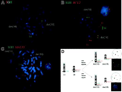 Fig. 1. Fluorescence in situ hybridization (FISH) for the detection of t(14;18)(q32;q21) involving IGH and MALT1 on metaphase chromosomes and interphase nuclei of a hepatic MALT lymphoma. / (A) The dual break-apart probe for IGH confirmed the rearrangement of the IGH locus showing the red signal on the der(14) and the green signal on the der(18), whereas the normal chromosome 14 carries the colocalization signal. By using probes forIGH and BCL2 (B), a split green signal forIGH is seen on der(14) and der(18), confirming the IGH translocation, however, the red signal for BCL2 is observed only on the der(14), indicating that the breakpoint is centromeric toBCL2. Moreover, the interphase nucleus does not showIGH/BCL2 fusion signals. The translocation ofMALT1 is demonstrated in (C), featuring a split signal for the red MALT1 probe in the aberrant metaphase on the der(14) and der(18) and fusion signals in both the metaphase and interphase. The interphase FISH assay schematically shown in (D) usesIGH and MALT1 probes for the detection of the t(14;18)(q32;q21) in isolated nuclei of routinely processed tissue.
