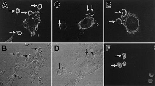 Fig. 5. Differential distribution of Felic and CIP4 during phagocytosis. / RAW264.7 macrophages were transfected with HA-Felic (A-B,E-F) or HA-CIP4 (C-D) and allowed to bind and initiate phagocytosis of IgG-opsonized SRBCs (A-D) or serum-opsonized zymosan (E-F). The cellular distribution of HA-Felic and HA-CIP4 was often cytosolic. HA-Felic was strongly recruited to phagocytic cups during phagocytosis of IgG-opsonized SRBCs (A-B, arrows) and serum-opsonized zymosan (E-F, arrows) and quickly dissociated from sealed phagosomes (A-B,E-F, asterisks). In contrast to Felic, CIP4 was weakly recruited to the sites of phagocytosis (C-D, arrows). Panels B, D, and F show the corresponding differential interference contrast images of panels A, C, and E, respectively. Original magnifications × 1000.