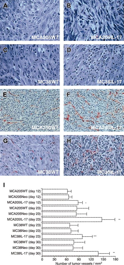 Fig. 2. Histologic examination of subcutaneous tumor tissues. / Tumor tissues were harvested, fixed in 10% buffered formalin, processed, embedded in paraffin, and sectioned with a microtome. Sections were stained with hematoxylin and eosin or with Factor VIII. (A) Hematoxylin-eosin–stained section from MCA205WT (original magnification × 150). (B) Hematoxylin-eosin–stained section from MCA205IL-17 (original magnification × 150). (C) Hematoxylin-eosin–stained section from MC38WT (original magnification × 150). (D) Hematoxylin-eosin–stained section from MC38IL-17 (original magnification × 150). Note: IL-17 transfectants were markedly infiltrated with neutrophils and were edematous. (E) Factor VIII–stained section from MCA205WT (original magnification × 80). (F) Factor VIII–stained section from MCA205IL-17 (original magnification × 80). (G) Factor VIII–stained section from MC38WT (original magnification × 100). (H) Factor VIII–stained section from MC38IL-17 (original magnification × 100). Note: Immunostaining for the presence of Factor VIII showed that tumors transduced with IL-17 were more markedly vascularized when compared with parental tumors. (I) Factor VIII–stained sections were evaluated by quantifying the number of stained blood vessels in 5 randomly chosen HPFs (× 200) per tumor. Bars represent mean number of vessels ± SD per square millimeter considering the area of HPF (n = 25). The result is a representative of 2 independent experiments. *P < .001; **P < .0001; ***P < .01.