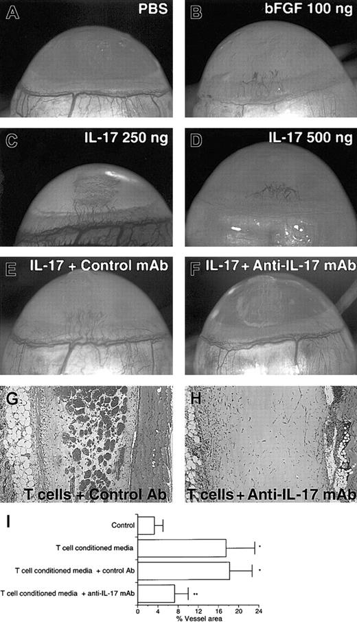 Fig. 3. IL-17 elicits neovascularization in rat cornea assay, and the addition of anti–IL-17 mAb into Matrigel suppresses the neovessel formation induced by CD4 T cells in mouse Matrigel assay. / (A) No angiogenic response to PBS was observed. (B-D) Vigorous angiogenic response to mouse IL-17 or human bFGF was observed. (E) IL-17–induced vessel formation (250 ng) was not abolished by control mAb. (F) IL-17–induced vessel formation (250 ng) was completely abolished by neutralizing anti–IL-17 mAb. (G) Matrigel plug containing CD4 T-cell–conditioned media plus 20 μg/mL control Ab. (H) Matrigel plug containing CD4 T-cell–conditioned media plus 20 μg/mL anti–IL-17 mAb. (I) Conditioned media from CD4 T cells were shown to induce neovascularization (T cells versus control;P < .05). The addition of neutralizing anti–IL-17 mAb to Matrigel resulted in marked reduction in neovessel formation elicited by CD4 T-cell–conditioned media (T cells or T cells + control Ab versus T cells + anti–IL-17 mAb; *P < .05). Results are expressed as percentage ± SD of the vessel area to the total Matrigel area assessed from 3 stained sections per Matrigel plug. Each individual experimental group included 5 mice. The result is a representative of 2 independent experiments.