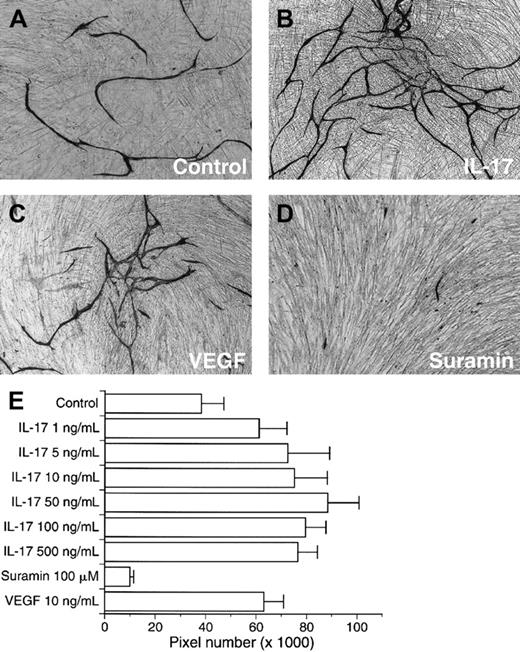 Fig. 5. IL-17 promotes endothelial cord formation. / (A) Factor VIII–stained microvessels developed by medium alone. (B) Factor VIII–stained microvessels developed by 50 ng/mL IL-17. (C) Factor VIII–stained microvessels developed by 10 ng/mL VEGF. (D) Factor VIII–stained microvessels developed by 100 μM suramin. (E) IL-17 (1-500 ng/mL) markedly enhanced the development of microvessel-like structures. VEGF (10 ng/mL) also promoted the microvessel formation. Suramin significantly inhibited the development of microvasculature. Bars represent the mean number of pixels ± SD (n = 6). The result is a representative of 2 independent experiments.