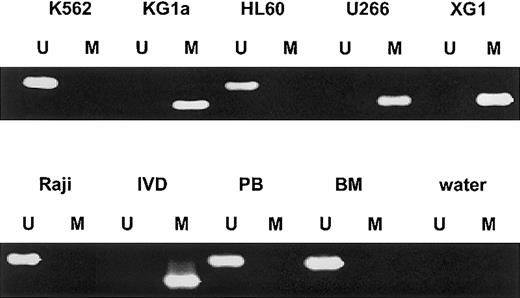 Fig. 1. SOCS-1 MSP analysis of hematopoietic cell lines, normal peripheral blood (PB), and nonmalignant bone marrow (BM). / Lane U indicates amplified product with primers recognizing unmethylated SOCS-1 sequence. Lane M indicates amplified product with primers recognizing methylated SOCS-1 sequence. The cell lines KG1a, U266, and XG1 show aberrant hypermethylation of the SOCS-1 CpG island. In vitro–methylated DNA (IVD) and water served as controls.
