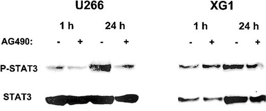 Fig. 4. Inhibition of STAT3 phosphorylation by AG490 in MM cell lines. / After starvation for 16 hours, cells were resuspended in complete culture medium with (+) or without (−) 50 μM AG490 and incubated for 1 hour and 24 hours. Cell lysates were analyzed by Western blot with anti–phospho-STAT3 antibody, and subsequently with anti-STAT3 antibody.