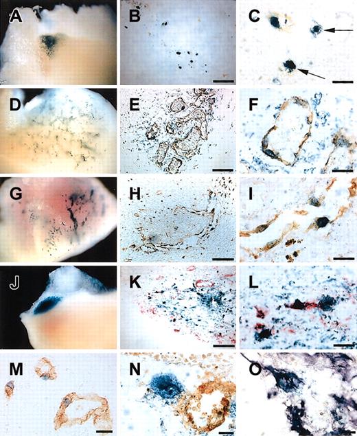 Fig. 2. Contribution of ES cell-derived VPCs to tumor angiogenesis. / (A,D,G,J) Whole-mount X-gal staining of the tumor. An X-gal analog, blue gal (Nacalai), was used as a substrate for staining 5 days after the injection of undifferentiated VPCs (A), differentiated VPCs (D), VE-cadherin+ fraction of differentiated VPCs (G), and PDGF-BB–treated VPC (J). Undifferentiated VPCs and PDGF-BB–treated VPCs formed cell aggregates with few vascular structures (A,J). Differentiated VPCs and VE-cadherin+fraction of differentiated VPCs generated rich vascular-like networks (D,G). (B,C,E,F,H,I,K-O) Immunohistochemical staining of tumor sections. Differentiated VPCs were specifically incorporated as LacZ (blue)/PECAM-1 (brown) double-positive cells into developing vasculatures (E-F). Undifferentiated VPCs were often detected as LacZ+/PECAM-1− cells (arrows; B-C). Implantation of VE-cadherin+Flk-1+ fraction of differentiated VPCs similarly generated specific vascular contribution as LacZ/PECAM-1 double-positive cells (H-I). Typical LacZ+PECAM-1+ cells (M) were observed in the differentiated VPC-injected tumor. LacZ (blue)/SMA (purple) double-positive and PECAM-1 (brown)-negative cells were also detected in the continuous sections (N-O). In the PDGF-BB–treated VPC transplantation group, some LacZ (blue)/SMA (red) double-positive cells were detected (K-L). Scale bars: panels B, E, H, K, 250 μm; panels C, F, I, L, 50 μm; panel M, 100 μm; panels N-O, 25μm.
