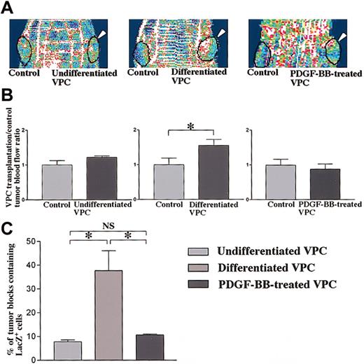 Fig. 3. Augmented blood flow in tumors by subcutaneous transplantation of VPCs and expansion of transplanted VPCs within the tumor. / . (A) LDPI analyses of blood flow in 3 VPC transplantation groups. Bilateral generation of C6-derived tumor (black circles) and unilateral transplantation of VPCs (arrowheads) in nude mice is shown. Differentiated VPC transplantation augmented blood flow of tumor (red to white colors) compared with control, whereas undifferentiated and PDGF-BB–treated VPCs did not (blue to green colors). (B) Quantitative analyses demonstrated the significant enhancement of differentiated VPC transplantation/control tumor blood flow ratios in nude mice. Data shown (mean ± SEM) are representative of 3 experiments. *P < .05. (C) Percents of the number of sectioned tumor blocks containing LacZ+ cells. About 40% of tumor blocks contained LacZ+ cells in differentiated VPC transplantation groups, whereas about 10% of them did in other VPC transplantation groups. The number of tumor blocks containing LacZ+ cells in differentiated VPC transplantation groups was significantly increased. Data shown (mean ± SEM) are representative of 3 experiments. *P < .01; NS,P > .05.