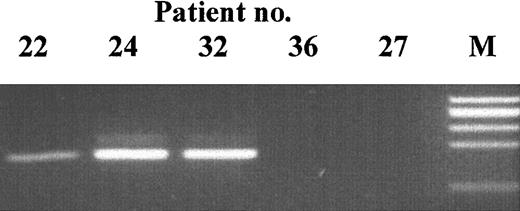 Fig. 5. Mutation-specific PCR products. / Patient DNA was amplified with primers specific for the 5-bp deletion at nt 662 to 666. The identity of the bands at 163 bp was confirmed by DNA sequencing. M indicates size marker.
