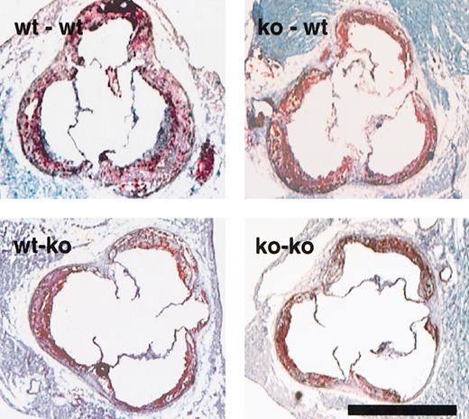 Fig. 3. Photographs of the aortic sinus of the animals with bone marrow transplants depict the atherosclerotic lesions formed. / Representative sections of the 4 different sets of animals, stained with oil red-O and counterstained with hematoxylin and light green are as indicated in upper left corner. Lesions of all genotypes show extensive foam cell accumulation. Bar = 1 mm.
