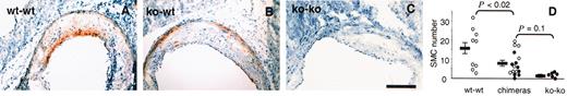Fig. 4. Immunohistochemical staining for α-actin shows positive SMCs in atherosclerotic lesions. / (A) wt-wt; (B) ko-wt; (C) ko-ko animals; bar = 0.2 mm; (D) α-actin–positive SMCs within lesions were counted on 5 aortic sinus sections 80 μm apart. Dots represent the mean number of SMCs per section for each animal. Black dots (●) correspond to animals that lack endothelial P-selectin (ie, wt-ko, ko-ko). Bars show the mean ± SEM for each group. The atherosclerotic lesions of the chimeric animals appear to have an intermediate content of SMCs.