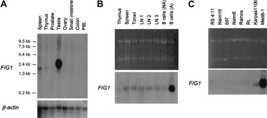 Fig. 3. Northern blot analysis of. / FIG1 expression in human tissues and B-cell lines. (A) Premade Nylon membrane (Clontech) loaded with 2μg poly A+ RNA per lane from spleen, thymus, prostate, testis, ovary, small intestine, colon, and peripheral blood leukocytes. (B) Total RNA (5 μg) from thymus, spleen, tonsil, reactive lymph nodes (LN1, LN2, LN3), resting tonsillar B cells (B cells NA), and IL-4+CD40L–activated tonsillar B cells (B cells A) was loaded on each lane. Ethidium bromide–stained 28S and 18S rRNA bands are shown for comparison (top). (C) Total RNA (5 μg) from human B-cell lines was loaded on each lane. Ethidium bromide-stained 28S and 18S rRNA bands are shown for comparison (top). Membranes were hybridized with the α-32P–labeled human FIG1 RDA fragment and the Clontech membrane (A) was also hybridized with aβ-actin probe as control.