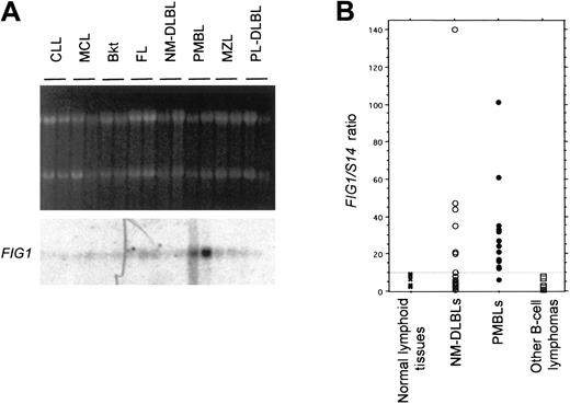 Fig. 4. Analysis of. / FIG1 expression in normal lymphoid tissues and B-cell lymphomas by Northern blot and quantitative RT-PCR. (A) Northern blot analysis of FIG1 expression in naive B-cell to post–germinal center B-cell–derived lymphomas. Total RNA (5 μg) from chronic lymphocytic leukemias (CLLs), mantle cell lymphomas (MCLs), Burkitt lymphomas (Bkt), follicular lymphomas (FLs), NM-DLBLs, PMBLs, marginal zone lymphomas (MZLs), and plasmablastic DLBLs (PL-DLBLs), was loaded on each lane. Ethidium bromide–stained 28S and 18S rRNA bands are shown for comparison (top). Hybond N+ membrane was hybridized with the α-32P–labeled human FIG1RDA fragment. (B) Quantitative RT-PCR analysis of FIG1expression in normal and tumoral lymphoid tissue samples.FIG1/S14 mRNA ratios were determined as indicated in “Materials and methods.” The FIG1/S14 mRNA ratios of normal lymphoid tissues (1 spleen, 1 thymus, 3 lymph nodes; ×), 18 cases of NM-DLBL (○), 17 cases of PMBL (●), and other B-cell lymphomas (2 CLLs, 2 MCLs, 2 Bkt, 2 FLs, 2 MZLs; ■) are represented in a scatter plot. The dashed line represents the cutoff ratio used to distinguish high and low levels FIG1 gene expression.
