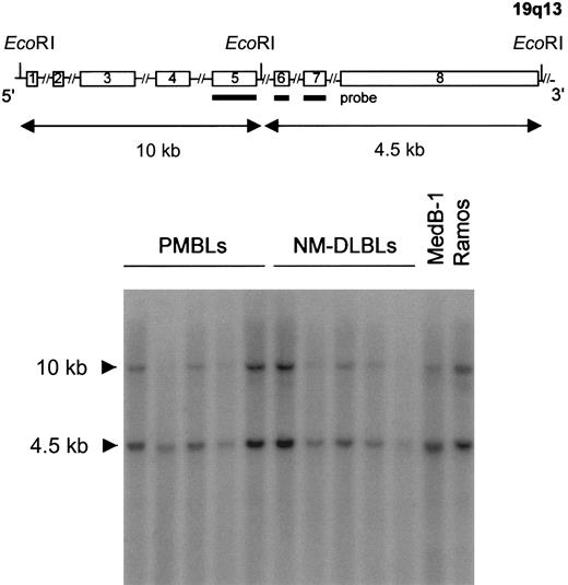 Fig. 5. Southern blot analysis. / Genomic DNA extracted from 5 PMBLs, 5 NM-DLBLs, and the MedB-1 and Ramos B-cell lines were subjected to EcoRI digestion, agarose gel electrophoresis, nylon N+ membrane transfer, and hybridization with an α-32P–labeled PCR-derivedFIG1 cDNA probe. A schematic map of the FIG1 gene is represented at the top of the figure (not drawn to scale). The probe used (bold line) spans FIG1 exons 5, 6, and 7, and hybridized with 10-kb and 4.5-kb DNA fragments in all samples.