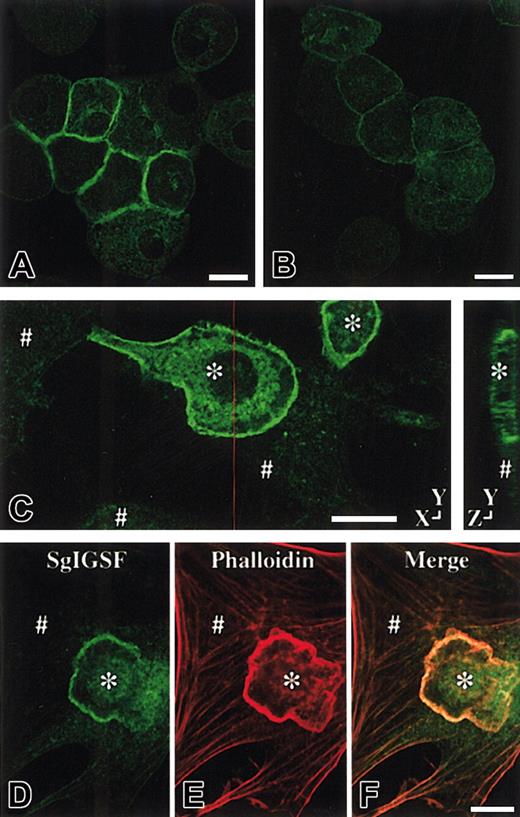 Fig. 4. Immunolocalization of SgIGSF in CMCs. / Immunocytochemical analysis of B6+/+ (A) and B6tg/tg (B) CMCs. Cytospin preparations of CMCs were fixed with methanol, reacted with the anti-SgIGSF antibody, and stained with FITC-labeled secondary antibody. Bar, 10 μm. (C) Immunocytochemical analysis of the coculture of B6+/+ CMCs and NIH/3T3 cells. CMCs were cocultured on the monolayer of NIH/3T3 cells for 3 hours. The coculture was fixed with methanol, reacted with the anti-SgIGSF antibody, and stained with FITC-labeled antibody. A representative set of X-Y and Y-Z sections is shown. A red line indicates the plane of the Y-Z section. (D-F) Colocalization of SgIGSF with polymerized actin filaments in the peripheral margin of B6+/+ CMCs that have adhered to NIH/3T3 cells. After CMCs were cocultured on the monolayer of NIH/3T3 cells for 3 hours, the coculture was fixed with paraformaldehyde, reacted with the anti-SgIGSF antibody, and stained with FITC-labeled secondary antibody (D). Subsequently, the culture was stained with TRITC-labeled phalloidin (E) and the FITC and TRITC images were merged (F). *B6+/+ CMCs; #NIH/3T3 cells. Bars, 10 μm.