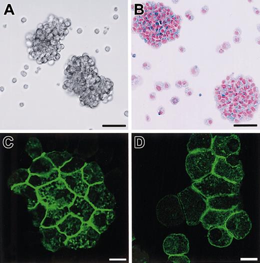Fig. 6. Phenotypes of B6tg/tg CMCs transfected with SgIGSF or +-MITF. / (A) Phase contrast image of B6tg/tgCMCs transfected with SgIGSF cDNA. Aggregates of the CMCs were floating in the medium. Bar, 50 μm. (B) Aggregates composed of numerous alcian blue–positive cells. Cytospin samples of B6tg/tg CMCs transfected with SgIGSF cDNA were stained with alcian blue and nuclear fast red. Bar, 50 μm. (C,D) Immunocytochemical analysis of B6tg/tg CMCs transfected with either SgIGSF cDNA (C) or +-MITF cDNA (D). Cytospin preparations of either type of cells were fixed with methanol, reacted with the anti-SgIGSF antibody, and stained with FITC-labeled secondary antibody. Bar, 10 μm.