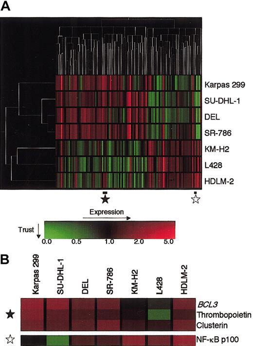 Fig. 1. Hierarchic clustering analysis of gene expression of 4 ALCL and 3 HD cell lines. / (A) Expression data of 110 genes were selected to optimally separate ALCL and HD. Analysis was performed with GeneSpring software. The unrooted tree of each axis, where the length of the branches represents a similarity in the distance of expression profiles, shows the relationship of the samples (left) and the genes (top). The gene expression values and trust are color-coded as indicated by the scale on the bottom: red indicates the expression level above a median level across all samples, green indicates below the median, and the brightness represents the trust of each value. (B) Enlargement of proportions of the expression profile indicated by stars in panel A. In this matrix, each column represents a sample and each row a gene.