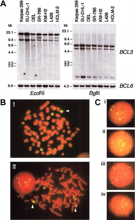 Fig. 4. BCL3 gene copies in ALCL cell lines. / (A) Southern blot analysis of DNA extracted from ALCL and HD cell lines. The membranes were sequentially hybridized with BCL3cDNA and BCL6 genomic DNA probes.HindIII-digested λ phage DNA was a molecular weight marker. (B) Chromosomal FISH analysis of Karpas 299 (i) and SU-DHL-1 (ii). Metaphase preparations were hybridized with a BAC clone containing the BCL3 locus, which was labeled with digoxigenin/antidigoxigenin-FITC. The chromosomes and nuclei were counterstained with propidium iodide (PI). The arrowheads indicate duplicated (i) and amplified (ii) BCL3 gene copies. (C) Interphase FISH analysis of Karpas 299 (i), SU-DHL-1 (ii), DEL (iii), and SR-786 (iv). Original magnification Bi-ii, × 1000; Ci-iv, × 1000.