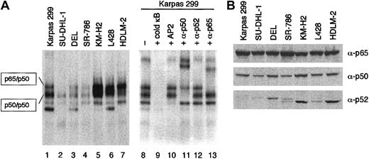 Fig. 7. Comparison of NF-κB activity between ALCL and HD. / (A) NF-κB DNA binding activity of ALCL (lanes 1 to 4) and HD (lanes 5 to 7) cells was analyzed by EMSA. The whole-cell lysates were incubated with 32P-labeled oligonucleotide probe containing a κB site and resolved on a 5% nondenaturing polyacrylamide gel. Supershift assay of Karpas 299 cells using antibodies against p65, p50, and p52 determined the components of NF-κB binding complexes (lanes 11 to 13). Lane 9, addition of an excess amount of unlabeled probe; lane 10, addition of the unlabeled AP2 probe (5′-GATCGAACTGACCGCCCGCGGCCCGT-3′) to eliminate nonspecific binding. (B) Western blotting analysis of ALCL and HD cell lines for the expression of p65, p50, and p52. Cell lysates were prepared from 1 × 106 cells, and an aliquot was loaded.