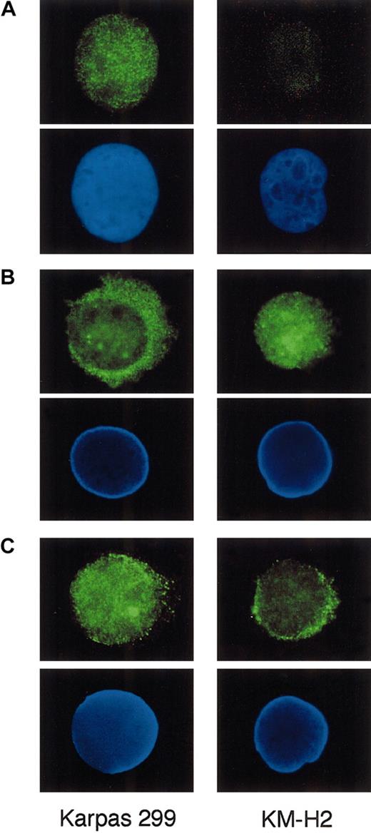 Fig. 8. Indirect immunofluorescence of Karpas 299 and KM-H2 cells against Bcl-3, p65, and p50. / Cytocentrifuged cells were incubated with anti–Bcl-3 (A), p65 (B), and p50 (C) antibodies and labeled with the Alexa 488–conjugated secondary antibody. The positions of nuclei, as revealed by DAPI staining in the lower panels. Original magnification × 1000.