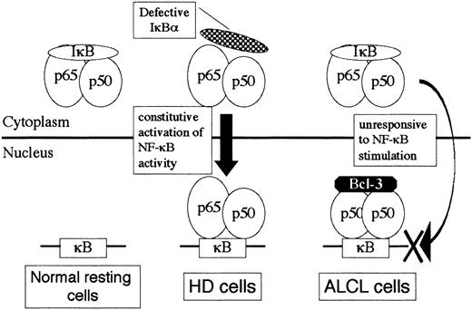 Fig. 9. A model for NF-κB/IκB/Bcl-3 interaction in HD and ALCL cells. / A hypothetical model for differential NF-κB binding activity between HD and ALCL focusing upon the inhibitory molecules IκBα and Bcl-3.