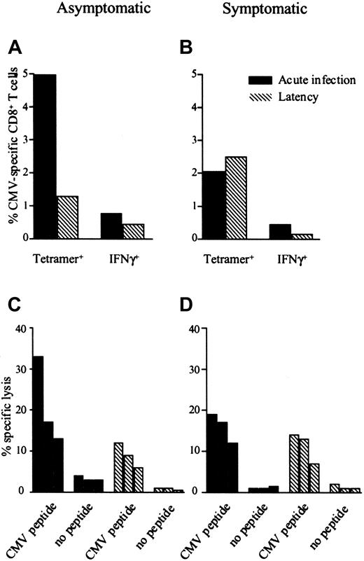 Fig. 4. Both asymptomatic and symptomatic individuals show functional CMV-specific CD8+ T cells. / The percentage CMV-specific CD8+ T cells enumerated by tetramer binding, percentage CMV-specific IFN-γ–producing CD8+ T cells enumerated by intracellular cytokine staining on specific peptide stimulation and specific lysis (E/T ratios, 1:1, 1:2, and 1:4) in one asymptomatic patient (patient 2, panels A,C) and one symptomatic patient (patient 6, panels B,D).