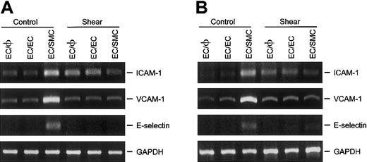 Fig. 4. Effect of membrane pore size on the expression of ICAM-1, VCAM-1, and E-selectin in ECs cocultured with SMCs. / ECs were cultured alone (EC/φ) or cocultured with identical ECs (EC/EC) or SMCs (EC/SMC), using membranes containing (A) 3-μm or (B) 8-μm pores. Cocultured ECs were maintained in a static condition or exposed to shear stress of 12 dyne/cm2 for 6 hours and their mRNA expression was determined by RT-PCR analysis, as described in “Materials and methods.” Amplification of cDNA was performed in parallel samples using human GAPDH primers. Data represent duplicate experiments with similar results.