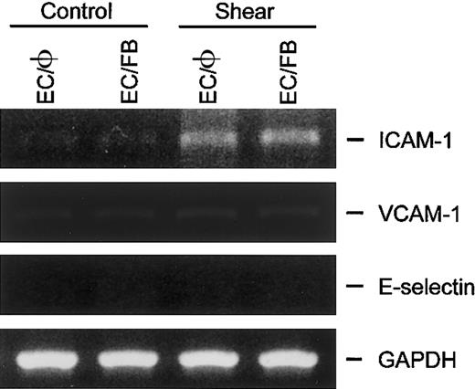 Fig. 5. ICAM-1, VCAM-1, and E-selectin gene expression in ECs cocultured with fibroblasts was not altered in response to static and flow condition. / ECs cultured alone (EC/φ) or cocultured with fibroblasts (EC/FB) were maintained in the static condition or exposed to shear stress of 12 dyne/cm2 for 6 hours and their mRNA expression was determined by RT-PCR analysis, as described in “Materials and methods.” Amplification of cDNA was performed in parallel samples using human GAPDH primers. Data shown are for a representative experiment. Similar results were obtained in a duplicate experiment.