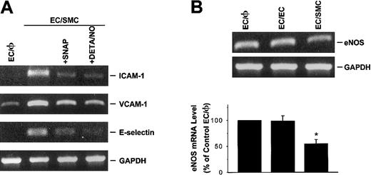 Fig. 6. NO modulates SMC-induced ICAM-1, VCAM-1, and E-selectin gene expression in cocultured ECs under the static condition. / (A) NO donor attenuates SMC-induced ICAM-1, VCAM-1, and E-selectin mRNA levels in cocultured ECs. ECs were pretreated with SNAP or DETA/NO for 30 minutes at a concentration of 100 μM and then cocultured with SMCs in the presence of the respective NO donors. Data represent duplicate experiments with similar results. (B) ECs cocultured with SMCs reduced their eNOS mRNA expression. ECs cultured alone (EC/φ) or cocultured with identical ECs (EC/EC) or SMCs (EC/SMC) were maintained in the static condition and their eNOS mRNA levels were determined by RT-PCR analysis, as described in “Materials and methods.” Amplification of cDNA was performed in parallel samples using human GAPDH primers. Data are presented as percentages of control EC/φ in band density normalized to GAPDH RNA levels, and are shown as mean ± SEM from 4 independent experiments. *P < .05 vs control EC/φ.
