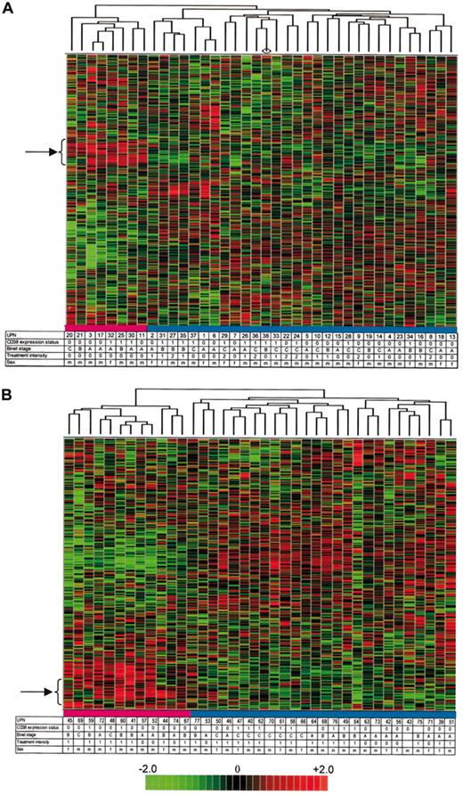 Fig. 2. Hierarchical clustering. / Color matrices show the hierarchical clustering of 2343 (A, UPN1-38) and 2769 (B, UPN 39-77) selected genes (see “Materials and methods”) of gene expression data obtained from 76 B-CLL patients. The hierarchical clustering algorithm used is based on the average-linkage method. Red areas indicate increased expression, and green areas indicate decreased expression. Each column represents a single B-CLL sample and each row a single gene. Tables beneath the heat maps detail the individual patients (UPN) and some of their clinical characteristics. Treatment intensity, 0; no previous treatment, 1; patients requiring minimal treatment, defined as less than 6 months of therapy in the years of follow-up, 2; patients requiring continuous chemotherapy or chemotherapy with 2 or more agents or regimens, 1. Dendrograms at the top show the degree to which each B-CLL patient is related to the others with respect to gene expression. Note the separation into 2 groups comprising 8 and 30 (A) and 12 and 26 patients (B), respectively. Clustering within the leftmost branches of the dendrograms was caused, in part, by the high expression of a large number of ribosomal and translation-associated genes (see arrows at the left side of the heat maps).