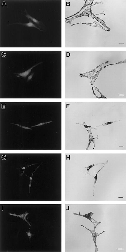 Fig. 4. Overexpression of Gln78Leu but not of Trp73Gly Rab27a mutants interferes with melanosome transport, a phenotype rescued by SHD-Mlph overexpression. / Melan-a cells were transfected with plasmids encoding pEGFP-C1 allowing soluble GFP expression (A), or cotransfected with pEGFP-C1 and pcDNA3 encoding Trp73Gly (C), Gln78Leu (E), SHD-Mlph (G), or Gln78Leu and SHD-Mlph (I) proteins. Panels B, D, F, H, and J are images of transmitted light showing the distribution of melanosomes. Bars indicate 20 μm.