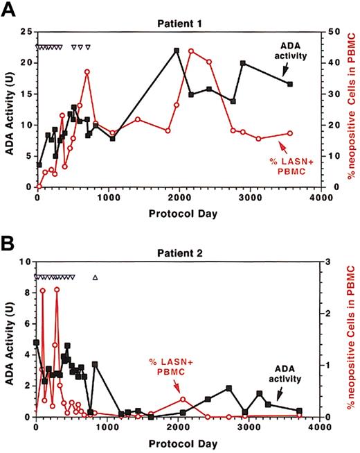 Fig. 1. ADA enzyme activity and vector detection in PBMCs of gene therapy patients. / (A-B) Units of cytoplasmic ADA enzyme activity (▪) and percentage of LASN vector–positive cells (○) detectable in patient circulating lymphocytes obtained prior to infusion during the treatment phase and at various time points after cell infusions ended. T-cell infusions for each patient are indicated by the inverted blue triangles. The infusion of CD34+ cells to patient 2 is indicated as an upright triangle.