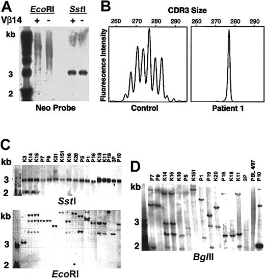 Fig. 4. Molecular analysis of patient 1's T-lymphocyte complexity. / (A) Patient 1's PBLs were separated into TcR Vβ14-positive and -negative fractions, cut with restriction enzymesSstI (double cutter) and EcoRI (single cutter). SstI digests demonstrate that the vector DNA has not been rearranged. The smear in the lanes cut withEcoRI indicates that there have been multiple LASN integrations. The first lane of panels A, C, and D contains molecular weight markers. (B) Spectratyping of TcR CDR3 of Vβ14 in PBMCs from a healthy control subject and patient 1. (C) Southern blot analysis of single cell clones. SstI andEcoRI digests. (D) BglII (single cutter) digests.