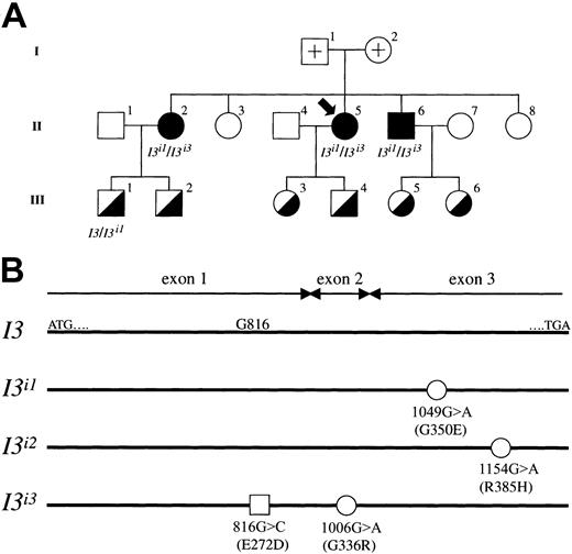 Fig. 5. Segregation of wild-type I3,I3i1, and I3i3 alleles in an adult i pedigree. / (A) Pedigree drawings I, II, and III represent the first, second, and third generation, respectively, and the propositus is indicated by an arrow. Filled and half-filled symbols for male (square) and female (circle) denote a person with adult i and common I phenotypes, respectively. Open symbols with a cross represent the parents of the propositus; the samples could not be obtained because they had already died. The other open symbols denote persons with common I phenotype, but genotyping was not conducted. The genotype of the half-filled symbols is a heterozygote of wild-type I3 and mutated alleles, though genotypic analysis of individuals 2, 3, 4, 5, and 6 in III was not conducted. All adult i phenotypes were derived from heterozygotes of mutated I3i1 andI3i3 alleles. (B) Schematic diagrams of mutated alleles found in the adult i pedigree. I3 indicates the coding region of the wild-type IGnT3 presented in this study. ATG and TGA denote the enzyme's translation initiation and termination codons, respectively. Open circles represent nucleotide substitutions 1049G>A in the I3i1 allele, 1154G>A in the I3i2 allele, and 1006G>A in theI3i3 allele, respectively. The alleleI3i3 was found in the present study, whereas alleles I3i1 and I3i2have already been reported by Yu et al.14 These mutations in I3i1, I3i2, andI3i3 predict amino acid alterations of Gly350Glu, Arg385His, and Gly336Arg, respectively. Note that positions 1154 and 385 in allele I3i2 are based on theIGnT3 gene nucleotide and deduced amino acid sequences, respectively. The open square represents a possible nonfunctional missense mutation in the allele I3i3 exon 1 ofIGnT3.
