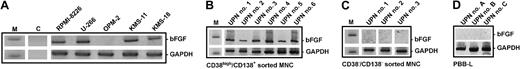 Fig. 1. Expression of basic fibroblast growth factor (bFGF) in myeloma cells. / Basic FGF transcripts (277 bp) in human myeloma cell lines (A) and in CD38high/CD138+ sorted myeloma cells from the bone marrow of representative patients (B; UPN nos. 1-6) were analyzed by RT-PCR. No bFGF transcripts were detected in the CD38−/CD138− nontumor cell fraction of corresponding marrow samples (C; UPN nos. 1-3). Peripheral blood B lymphocytes (PBB-Ls) obtained from healthy volunteers served as additional negative controls (D). DNA ladder marker (M) indicates 300 bp (upper rows) and 200 bp (lower rows). Glyceraldehyde-3-phosphate dehydrogenase (GAPDH; 226 bp) was used as a control for RNA integrity. C indicates nontemplate PCR control.