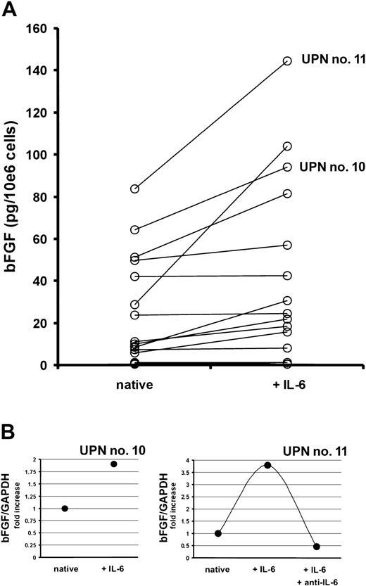 Fig. 8. Effect of interleukin-6 (IL-6) on the production of basic fibroblast growth factor (bFGF) by purified marrow myeloma cells from patients (n = 18). / (A) Basic FGF concentrations in supernatants of myeloma cell cultures after exposure to 0 (native) or 10 ng/mL of IL-6 for 72 hours, presented as pg/mL corrected for 106 cells.P < .002 for difference between native and IL-6–stimulated myeloma cells (Wilcoxon test). (B) Quantitative bFGF-RT-PCR in CD38high/CD138+ marrow myeloma cells of 2 patients (UPN nos. 10 and 11) after exposure to 0 (native) or 10 ng/mL of IL-6 with or without anti–IL-6 for 72 hours. Basic FGF-RT-PCR was performed as described in “Patients, materials, and methods.” Ratios of bFGF over glyceraldehyde-3-phosphate dehydrogenase (GAPDH) expression are depicted as fold increase over unstimulated controls. Corresponding patient numbers (UPN) are indicated in panels A and B.