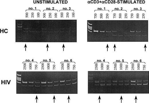 Fig. 5. Quantification of B7-H1–specific mRNA. / (Upper panels) Quantification of B7-H1–specific mRNA in resting (unstimulated; left panel) or in anti-CD3+anti-CD28−–stimulated (right panel) PBMCs of 3 representative healthy controls. (Lower panels) Quantification of B7-H1–specific mRNA in resting (unstimulated; left panel) or in anti-CD3+anti-CD28–stimulated (right panel) PBMCs of 3 representative HIV-infected patients. The upper bands show cDNA retrotranscribed from mRNA extracted from PBMCs; the lower bands show different dilutions (eg, 500, 250, 100) of the specific competitors. The arrows show the dilution at which equivalence is observed between sample cDNA and the specific competitors.