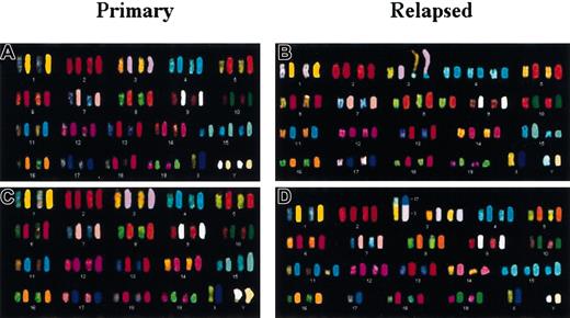 Fig. 4. Different chromosomal abnormalities in primary versus relapsed. / MYC-induced tumors. (A-D) SKY showing the complete karyotypes and chromosomal abnormalities in 2 primary and corresponding relapsed tumors. (A) Primary tumor 967 has trisomy 15 and 2 Y. (B) Relapsed tumor 967 R2 contains trisomy 4 and 8, HSRs on Chr 8 and 15, and nonreciprocal translocation t(3;4). Note that most of the metaphases from 967 R2 exhibited a loss of chromosome 8. (C) Primary tumor 6816 displays HSRs on Chr 15 and Y. (D) Relapsed tumor 6816 R3 exhibits trisomy 3, 11p+ and 15, and nonreciprocal translocation t(3;17).