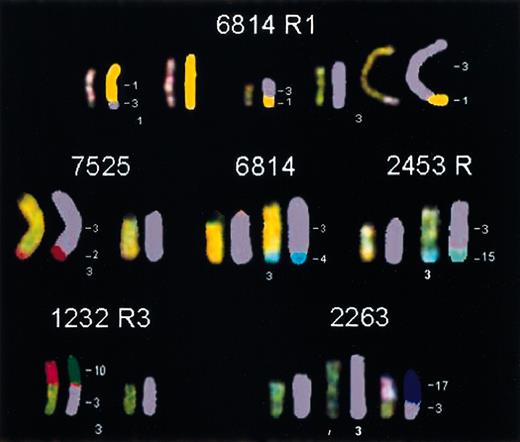 Fig. 5. Novel translocations involving chromosome 3 in different. / MYC-induced lymphomas. In tumor 6814 R1, a reciprocal translocation, t(3;1), was found. Tumors 7525, 6814, and 2453 R all contained a nonreciprocal translocation in which part of chromosome 2, 4, or 15, respectively, had been translocated to the telomeric end of Chr 3. Tumor 1232 R3 and tumor 2263 harbored a translocation in which the entire chromosome 10 or 17, respectively, was translocated to the proximal part of Chr 3.