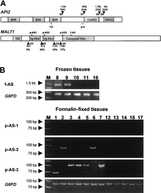 Fig. 1. Gene structure, primer position, and RT-PCR results. / (A) Schematic representation of the API2 andMALT1 gene structure and primer position. Known breakpoints are indicated by arrowheads, and the nucleic acids are numbered according to the cDNA sequence of the API2 (GenBank no. NM001165) and MALT1 gene (GenBank no. AF130356). The incidences of these breakpoints were given in percentages. The position of primers used for frozen tissue are indicated by f-S and f-AS, whereas the position of primers used for fixed tissue are indicated by p-S, p-AS1, p-AS2, and p-AS3. (B) The upper panel shows the RT-PCR results from cases with frozen tissues. The lower panel displays the RT-PCR results from cases with fixed tissue. The numbers correspond to the case number in Table 1.