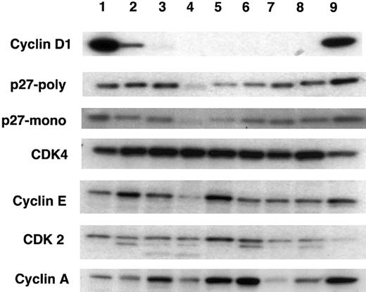 Fig. 1. Western blot analysis for cyclin D1, p27Kip1, and other cell cycle–related proteins in lymphoid cell lines. / Each lane contains 30 μg protein extract from the following cell lines: lane 1, Granta 519; lane 2, NCEB-1; lane 3, SUDHL-4; lane 4, SUDHL-6; lane 5, Thomas; lane 6, Molt4; lane 7, KiJK; lane 8, SUDHL-10; lane 9, KMS12. Lanes 1 (Granta 519), 2 (NCEB-1), and 9 (KMS12) represent the t(11;14) translocated cell lines. Expression of cyclin D1 is limited to these 3 cell lines. These cell lines also show strong positivity for p27Kip1 although several of the non-t(11;14) translocated cell lines also show relatively high levels of p27Kip1. Note that the cell lines with positivity for cyclin D1 have the strongest positivity for p27Kip1. Cyclin E, cyclin A, CDK4, and CDK2 expression is present in all cell lines with no apparent correlation between any of these proteins and either cyclin D1 or p27Kip1.