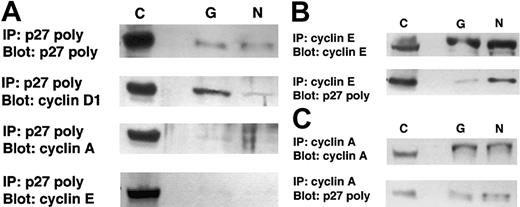 Fig. 6. Coimmunoprecipitation studies of p27Kip1with cyclin E, cyclin A, and cyclin D1 in t(11;14) cell lines. / (A) The cell lines Granta 519 (G) and NCEB-1 (N) were immunoprecipitated with agarose-conjugated anti-p27Kip1. Western blots were probed with either p27Kip1, cyclin E, cyclin A, or cyclin D1. In both cell lines, the predominant cyclin recovered from p27Kip1 immunoprecipitates is cyclin D1. (B) In the inverse assay, the cell lines were immunoprecipitated with agarose-conjugated anticyclin E and blotted with polyclonal p27Kip1 antibody. p27Kip1 was recovered in cyclin E immunoprecipitates from NCEB-1. (C) The cell lines were immunoprecipitated with agarose-conjugated cyclin A and blotted with p27Kip1. A faint band is observed in Granta 519 and in NCEB-1. C indicates positive control, 60 μg total protein; IP, immunoprecipitation, 300 μg total protein.