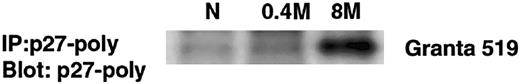 Fig. 7. Immunoprecipitation of p27Kip1 following denaturation with 8 M urea. / Prior to immunoprecipitation with the polyclonal anti-p27Kip1 (C-19), the protein extracts were either treated with 8 M urea and subsequently diluted 1:20 as described in “Materials and methods” (lane 8M) or treated by dilution with buffer not containing urea (N), or diluted with buffer in a final concentration of 0.4 M urea (lane 0.4M). The p27Kip1 antibody immunoprecipitates significantly more p27Kip1 protein following denaturation of cell lysates with 8 M urea. Note that there is practically no difference in the expression of p27Kip1 between the extracts with native conditions and the one treated with 0.4 M urea.