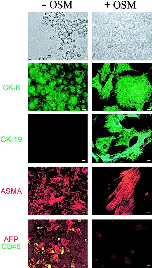 Fig. 4. Effect of OSM on murine fetal liver cells from primary cultures. / Fetal hepatic cells derived from 14 dpc fetal liver were cultured for 10 days in long-term culture medium in the absence or presence of 10 ng/mL OSM. Cells were then washed, fixed, and stained with mouse anti–CK-8, –CK-19 (green), and -ASMA (red). Cells were also double-labeled with antibodies to epithelial and hematopoietic cells using goat anti-AFP (red) and rat anti-CD45 (green). Each panel represents a different field. Scale bar = 5 μm.