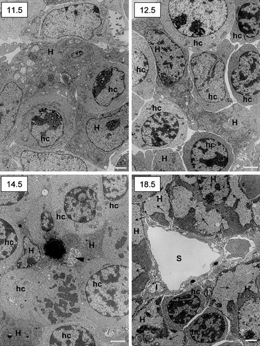 Fig. 8. Ultrastructural studies of murine fetal livers. / The 11.5, 12.5, 14.5, and 18.5 dpc murine livers were fixed and prepared for transmission electron microscopy. Scale bar = 1 μm. H indicates hepatoblasts (11.5, 12.5, and 14.5 dpc) or hepatocytes (18.5 dpc); hc, hematopoietic cells; I, Ito cells; S, sinusoid; arrowhead (14.5), bile canalicule; arrows (18.5), glycogen deposits.