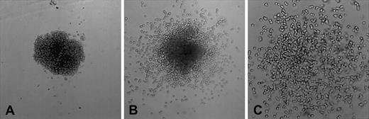 Fig. 1. Myeloid colonies from fetal liver or bone marrow grown in methylcellulose medium containing IL-3, IL-6, GM-CSF, and SCF. / Colonies of types A, B, and C are as described in “Results.” Type A colonies are rarely found in wild-type mice. Original magnification, × 10.