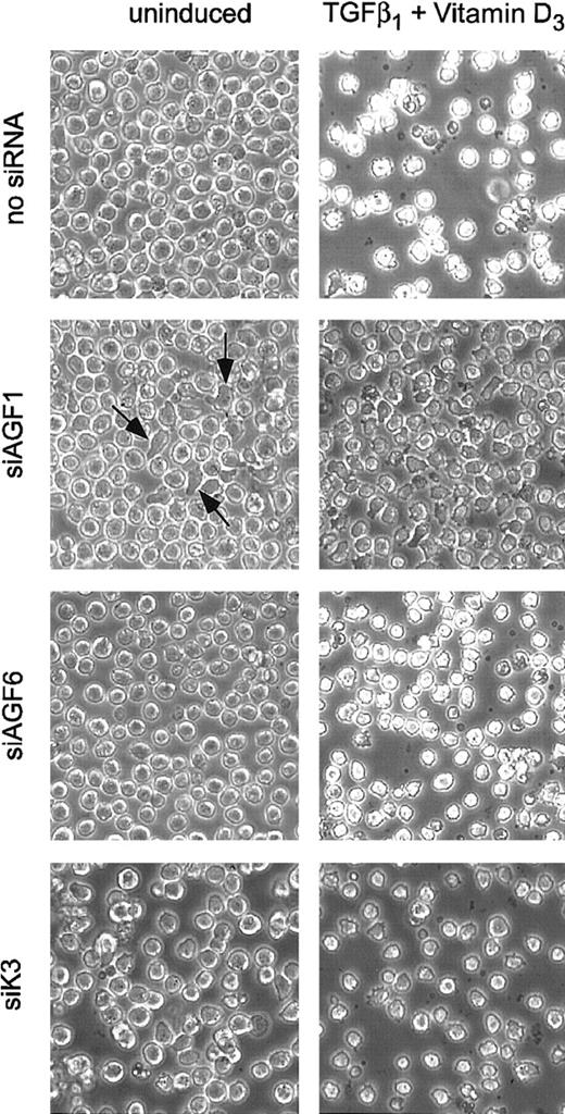 Fig. 3. Morphology of siRNA-treated Kasumi-1 cells. / Cells were analyzed by phase-contrast microscopy 4 days after electroporation with 100 nM of the indicated siRNAs. Left column, uninduced cells; right column, cells induced with TGFβ1and vitamin D3. siRNAs are indicated on the left. The original magnification was × 100. Some irregularly shaped cells obtained after electroporation with siAGF1 are marked with arrows. For siRNA nomenclature and target sites, see Table 1.