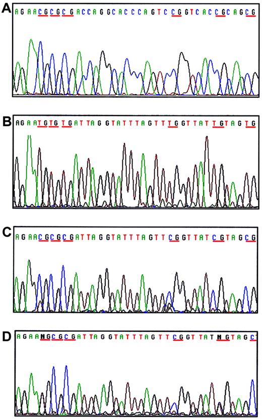 Fig. 3. Examples of methylation analysis of CpG islands at the promoter area of JunB gene. / The sequence shown corresponds to the −77 to −116 to the transcriptional start site of JunB gene. (A) Unmodified DNA with all the cytokines remains intact. (B) Modified DNA of an unmethylated sample with all the cytokines converted to thymidine. (C) Modified DNA of a methylated sample with all Cs in CpG dinucleotides remaining as C. (D) Modified DNA of a partially methylated sample with part of the Cs in CpG dinucleotides showing C/T heterozygosity. Blue indicates cytosine (C); black, guanine (G); red, thymidine (T); and green, adenosine (A).