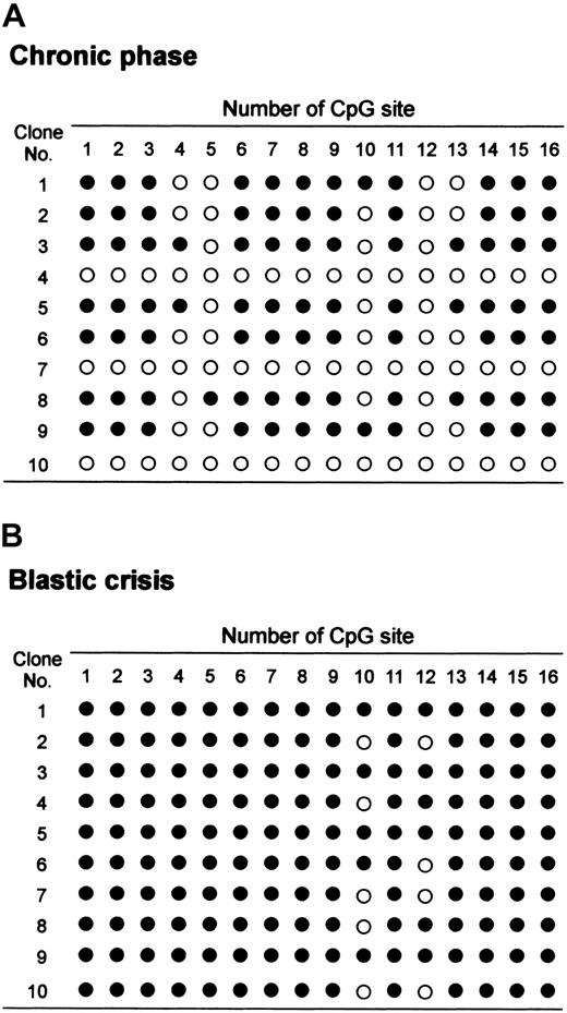 Fig. 4. Allelic patterns of CpG site methylation at the promoter area of JunB gene. / Methylation of the JunB CpG island located between positions −89 to −224 corresponding to the transcriptional starting site was examined by genomic bisulfite sequence analysis. Ten clones were randomly selected and sequenced. Methylated CpG sites are marked as filled circles (●) and unmethylated sites as open circles (○). (A) The allelic patterns of chronic phase of a representative CML case. (B) The allelic patterns of blastic crisis of a representative CML case.